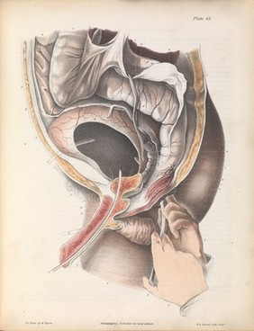 Plate LXV. Surgical anatomy for the puncture of the bladder.