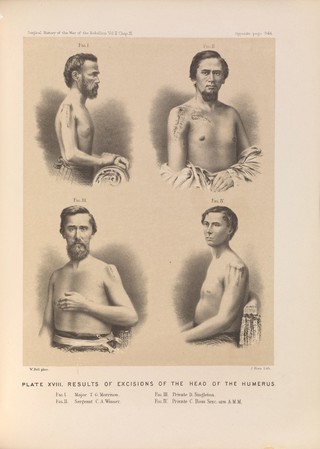 The medical and surgical history of the war of the rebellion, (1861-65) / Prepared, in accordance with the acts of Congress, under the direction of Surgeon General, Joseph K. Barnes, United States Army.