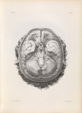 Traité complet de l'anatomie de l'homme comprenant la médecine opératoire ... : avec planches lithographiées ... / par N.H. Jacob.