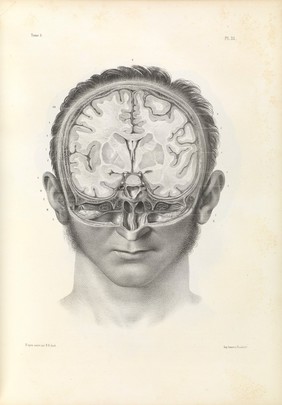 Traité complet de l'anatomie de l'homme comprenant la médecine opératoire ... : avec planches lithographiées ... / par N.H. Jacob.