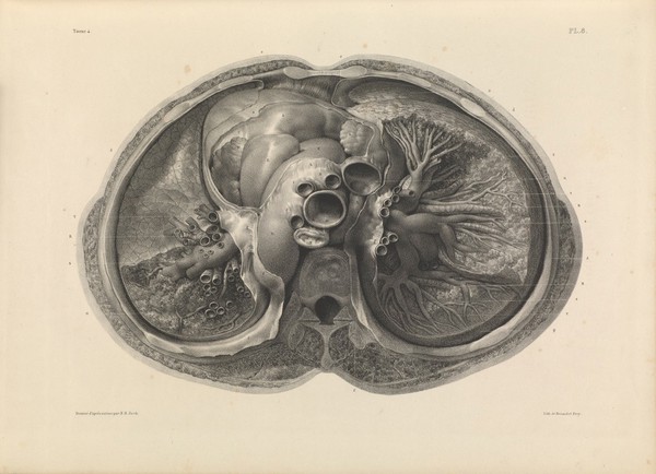 Traité complet de l'anatomie de l'homme comprenant la médecine opératoire ... : avec planches lithographiées ... / par N.H. Jacob.