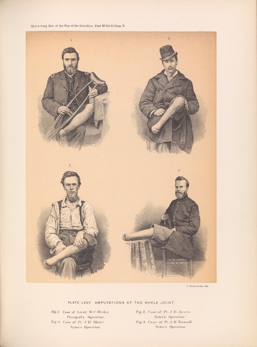 Plate LXXXV. Four veterans with amputations at the ankle.