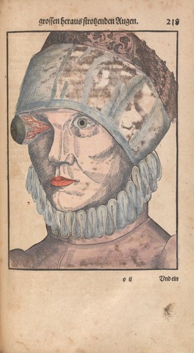 Ophthalmodouleia. Das ist Augendienst. Newer vnd wolgegründter Bericht von Ursachen vnd Erkentnüs aller Gebrechen, Schäden vnd Mängel der Augen vnd des Gesichtes, wie man solchen anfenglich mit gebürlichen mitteln begegenen, vorkommen vnd wehren, auch wie man alle solche gebresten künstlich durch Artzney, Instrument vnd Handgrieffe curiren, wircken vnd vertreiben sol ... / Durch George Bartisch.