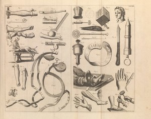 view Table XXXII-XXIII. A medicinal dictionary, 1743-45.