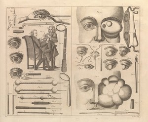 view Table XXXVIII-XXXIX. A medicinal dictionary, 1743-45.