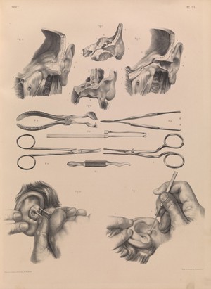 view Plate 13. Surgical anatomy of the ear