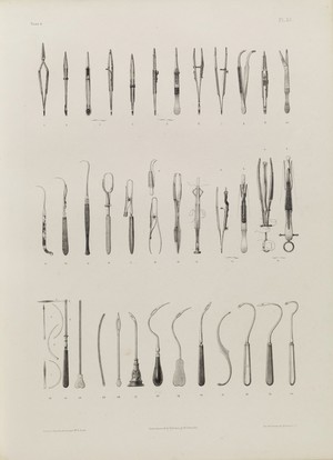 view Plate 33. Surgical instruments for ligation of arteries.