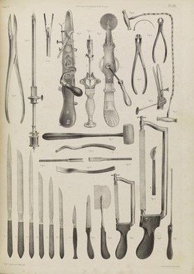 Plate 55. Surgical instruments for operating on the bones.