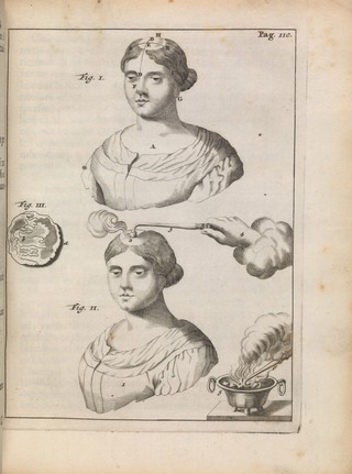 Exercitationes practicae circa medendi methodum, auctoritate, ratione, observationibusve plurimis confirmatae ac figuris illustratae ... / [Frederick Dekkers].