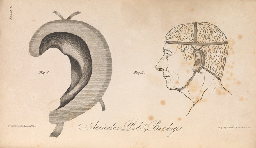 Illustrations of acoustic surgery / By Thomas Buchanan.