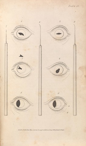 Lectures on the operative surgery of the eye : or, an historical and critical inquiry into the methods recommended for the cure of cataract, for the formation of an artificial pupil, &c. &c. &c. Containing a new method of operating for cataract by extraction. Being the substance of that part of the author's course of lectures on the principles and practice of surgery which relates to the operations on that organ / By G. J. Guthrie.