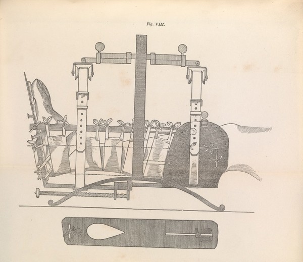 On a new method of managing fractures : from the address in surgery, delivered at the Twentieth Anniversary Meeting of the Provincial Medical and Surgical Association, held at Oxford, on Wednesday and Thursday, July 21st and 22nd, 1852 / by James Torry Hester, fellow of the Royal College of Surgeons, surgeon to the Radcliffe Infirmary, Oxford.