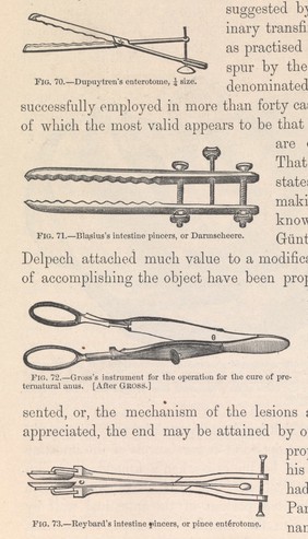 The medical and surgical history of the war of the rebellion, (1861-65) / Prepared, in accordance with the acts of Congress, under the direction of Surgeon General, Joseph K. Barnes, United States Army.