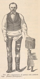 The medical and surgical history of the war of the rebellion, (1861-65) / Prepared, in accordance with the acts of Congress, under the direction of Surgeon General, Joseph K. Barnes, United States Army.