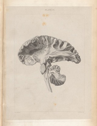A series of engravings intended to illustrate the structure of the brain and spinal chord in man / [Herbert Mayo].