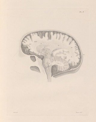 Anatomie et physiologie du système nerveux en général, et du cerveau en particulier, avec des observations sur la possibilité de reconnoître plusieurs dispositions intellectuelles et morales de l'homme et des animaux par la configuration de leurs têtes / Par F. J. Gall et G. Spurzheim.