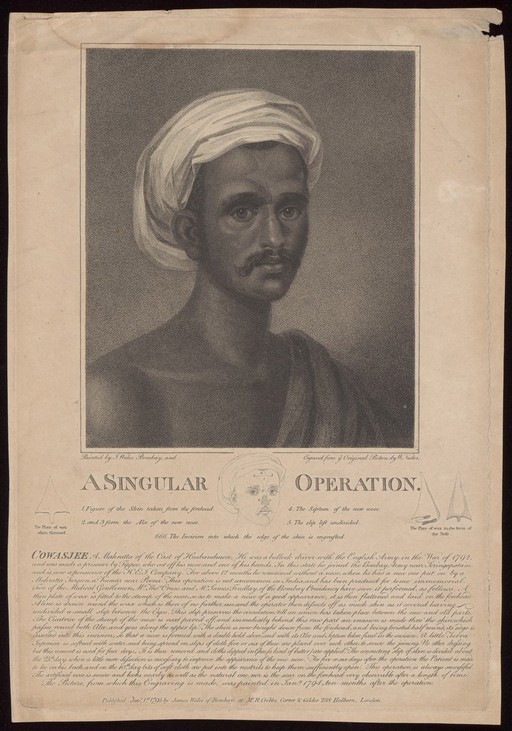 Cowasjee, a man who had his nose reconstructed with the aid of plastic surgery. Stipple engraving by W. Nutter, 1795, after J. Wales.