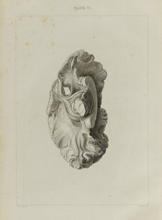 A series of engravings intended to illustrate the structure of the brain and spinal chord in man / [Herbert Mayo].
