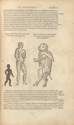 Les œuvres d'Ambroise Paré ... Diuisees en vingt huict liures, auec les figures et portraicts, tant de l'anatomie, que des instruments de chirurgie, et de plusieurs monstres. Reueuës et augmentees par l'autheur.