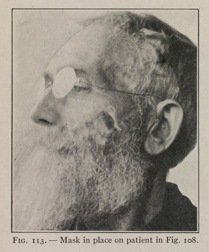 Reclaiming the maimed : a handbook of physical therapy / by R. Tait McKenzie.