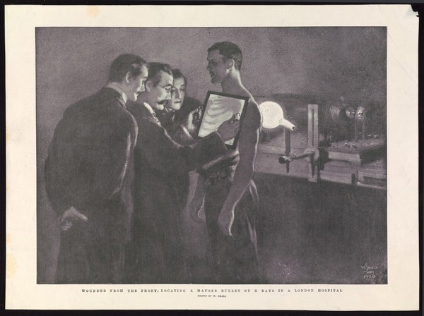 Surgeons examining a Mauser bullet in a man's chest via the use of an X-ray. Halftone, 1900, after W. Small.