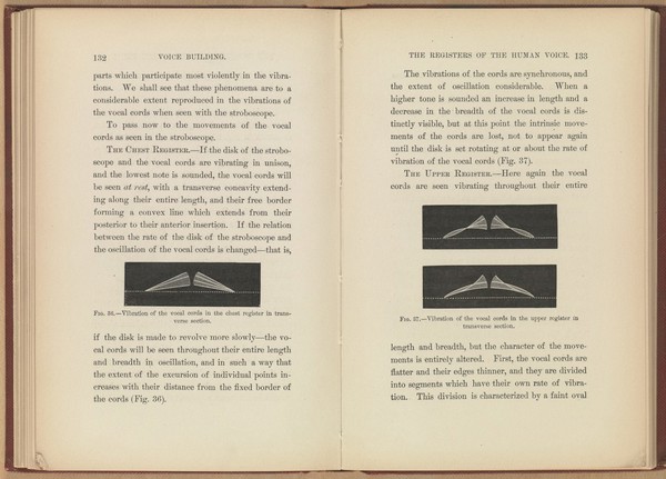 Voice building and tone placing : showing a new method of relieving injured vocal cords by tone exercises / by H. Holrook Curtis.