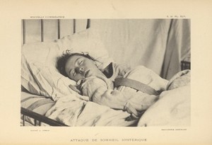 view Female patient with hysteria-induced narcolepsy.