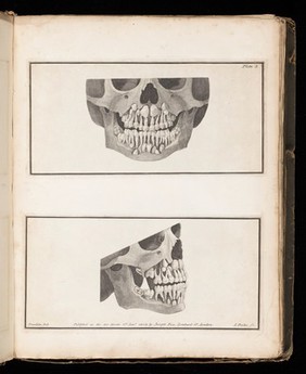 The teeth of a child between four and five years of age. 