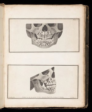 view The teeth of a child between four and five years of age. 