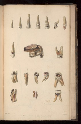 Plate 7. Various examples of decayed teeth
