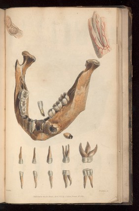 Plate 1. The lower jaw of a seven to eight year old child. 