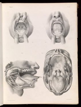 Plate 14. Oral cavity.