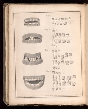 Plate 2, The development of teeth from birth to 2 to 3 years