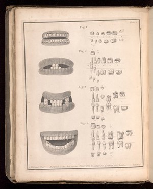 view Plate 2, The development of teeth from birth to 2 to 3 years