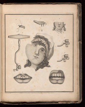 Plate VII. Various facial and tooth disorders