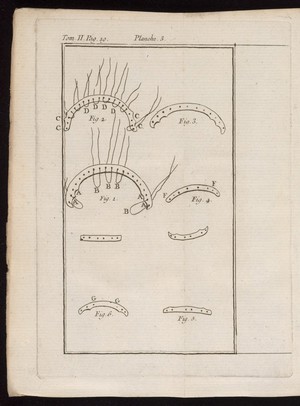 view Dental prosthetics, M. Bourdet, 18th century.