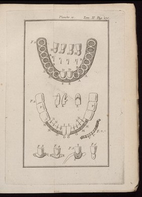 Dental prosthesis, 19th century