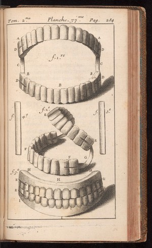 view Artificial teeth