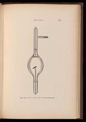 A W L Tube with Vacuum Regulator