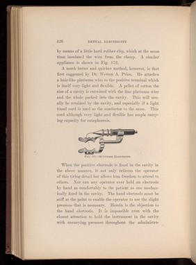 McIntosh Electrode. Fig. 172, page 426, 'Dental Electricity' by Levitt E Custer, 1901.