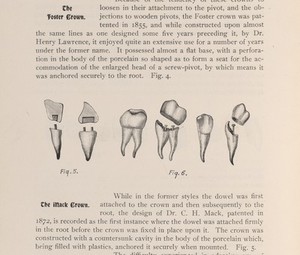 view Dental crowns.