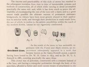 view The Gates-Bonwill and Howland-Perry crowns.