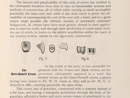 The Gates-Bonwill and Howland-Perry crowns.