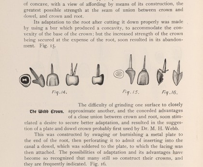 Logan, Brown and Webb designed crowns.