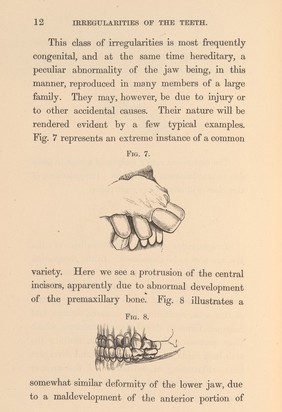 Irregularities and diseases of the teeth, p. 12