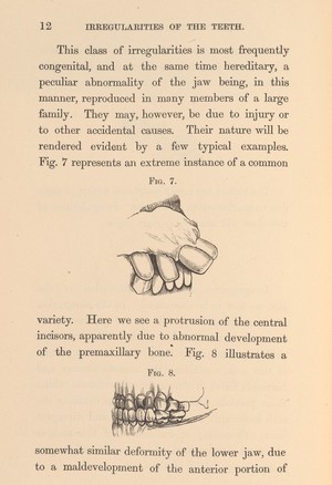 view Irregularities and diseases of the teeth, p. 12