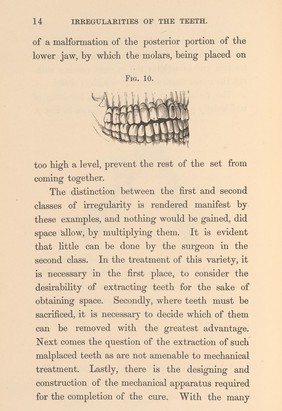 Irregularities and diseases of the teeth, p. 14.