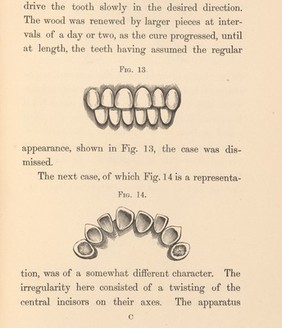 Irregularities and diseases of the teeth, p. 17.