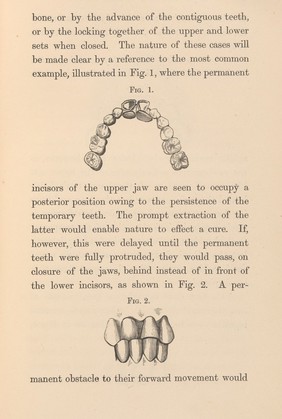 Irregularities and diseases of the teeth, p. 7.