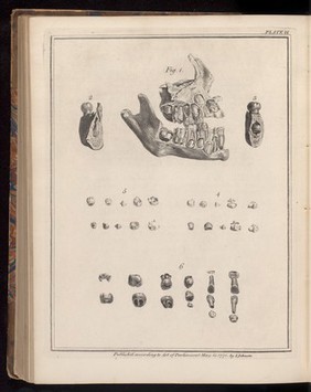 Plate IX, The natural history of the human teeth.